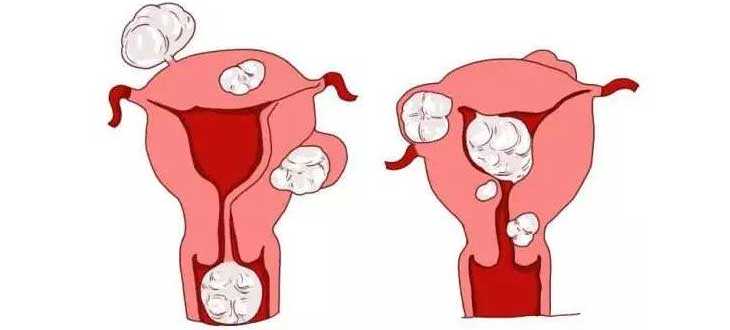 胎停的染色体异常_垂体功能亢进,崇左卵巢早衰能不能做3代试管，卵巢早衰试管