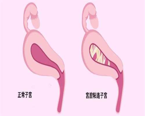 上海正规代怀孕公司推荐_上海上海代孕代孕便宜