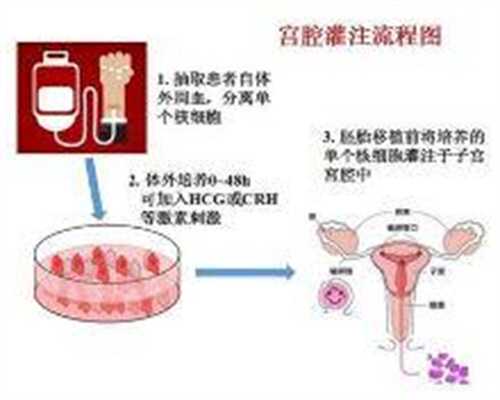 上海代怀孕公司_上海代孕流程_做“试管婴儿”的