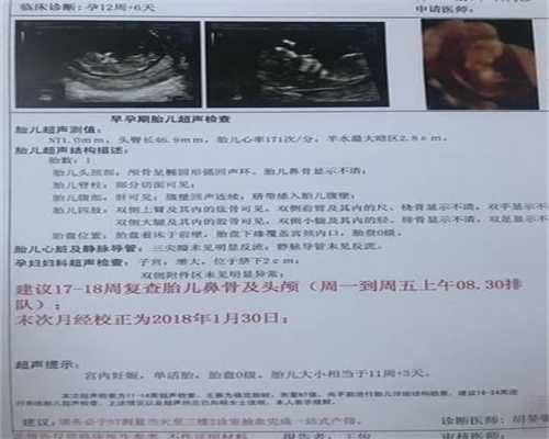 上海代孕网站_上海世纪代怀孕哪里找_民航上海医