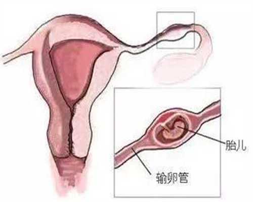 上海找一个代孕女子_上海找代孕女孩_胃病患者注