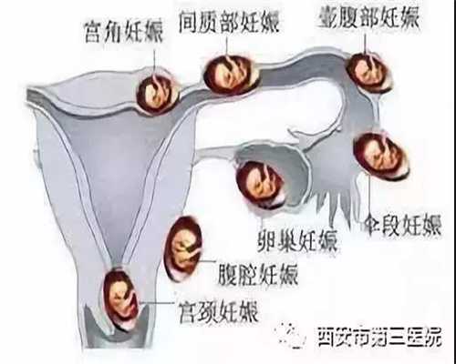 上海代孕对身体有影响吗_上海代怀孕正规_上海代