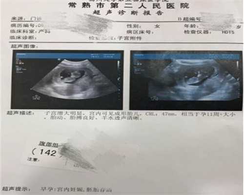 上海代孕哪家好_上海供卵最好的医院_泰嘉股份是好股吗-供卵机构口碑好助孕剖