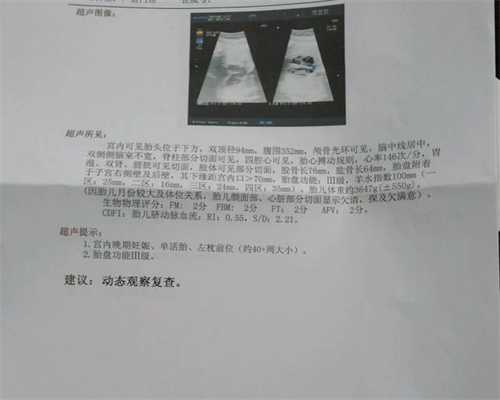 上海代孕的价位_上海试管找捐卵代码_上海中泰助孕地址-为什么肚脐突出是男孩