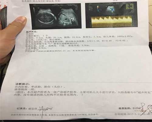 上海代孕合同需要注意哪些_上海代孕中介怎么样_代孕哪里正规-代孕需要什么证